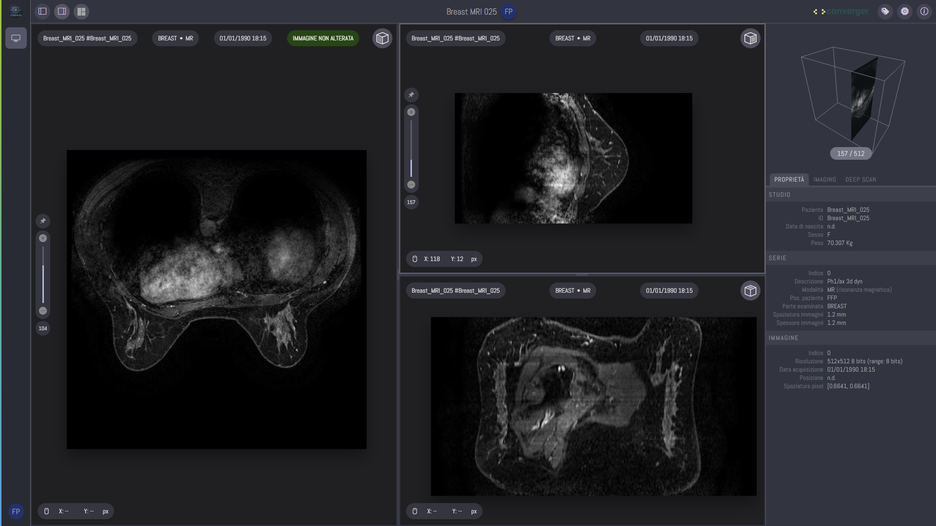 XDeepScan